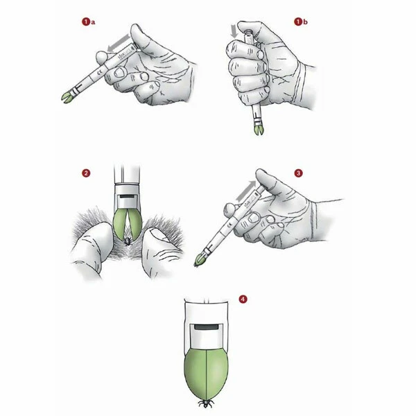 TickSAFE Zeckengreifer 2 TickSAFE Zeckengreifer – Bild 2